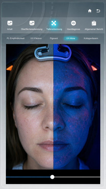 LitTeks 3D-Hautanalysegerät – Mobiler Gesichtsscanner mit intelligentem Analyse-Display